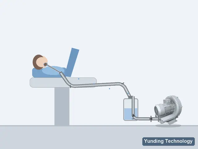 Dental Fluid Suction